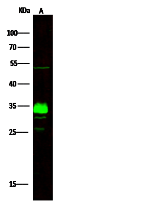 Recombinant ING5 Monoclonal Antibody - small - 2