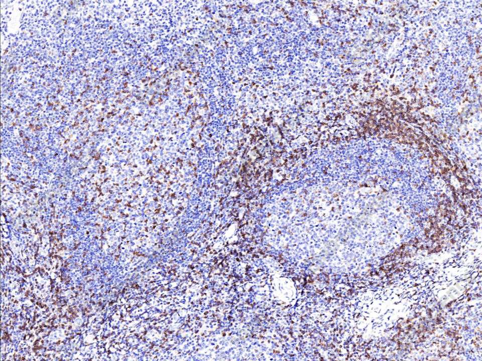 Recombinant CD3d/CD3 delta Monoclonal Antibody - 1