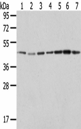 Western Blot analysis of Raji, A549, Hela, HepG2, 231, K562 and A431 cells using ERP44 Polyclonal Antibody at dilution of 1/200