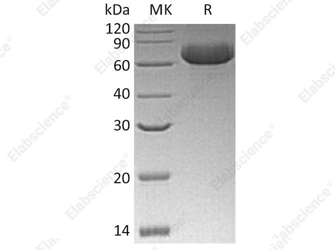 Recombinant Human GFRRA2 Protein (His Tag) - 1