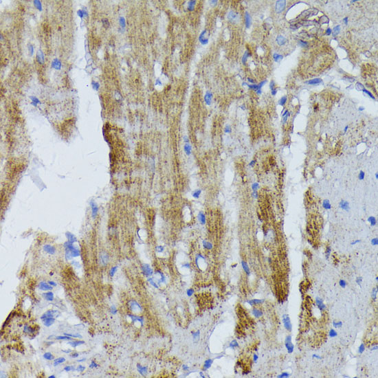 Immunohistochemistry of paraffin-embedded mouse heart using ACADL Polyclonal antibody at dilution of 1:100 (40x lens).Perform microwave antigen retrieval with 10 mM PBS buffer pH 7.2 before commencing with IHC staining protocol.