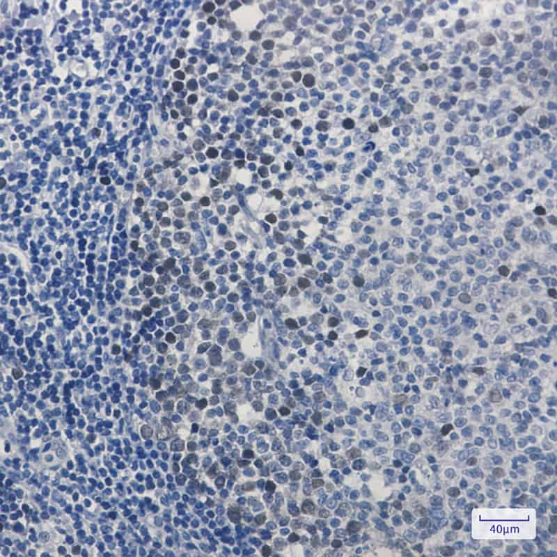 Immunohistochemistry of Cdk2 in paraffin-embedded Human tonsil using Cdk2 Rabbit mAb at dilution 1:100