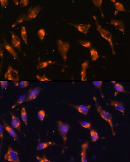 Immunofluorescence analysis of L929 cells using SSTR2 Polyclonal Antibody at dilution of  1:100 (40x lens). Blue: DAPI for nuclear staining.