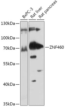 Western blot analysis of extracts of various cell lines using ZNF460 Polyclonal Antibody at 1:1000 dilution.