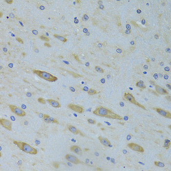 Immunohistochemistry of paraffin-embedded Rat brain using SARS Polyclonal Antibody at dilution of 1:100 (40x lens).