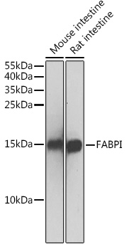 Western blot analysis of extracts of various cell lines using FABPI Polyclonal Antibody at 1:500 dilution.