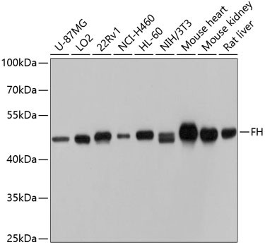 Western blot analysis of extracts of various cell lines using FH Polyclonal Antibody at dilution of 1:1000.