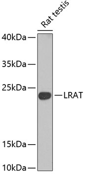 Western blot analysis of extracts of Rat testis using LRat Polyclonal Antibody at dilution of 1:1000.