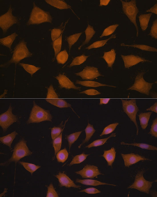 Immunofluorescence analysis of L929 cells using Cyclin A2 Polyclonal Antibody at dilution of 1:100. Blue: DAPI for nuclear staining.