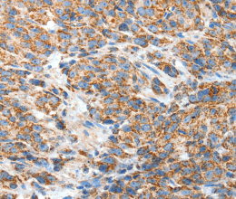 BAK1 Polyclonal Antibody - 2