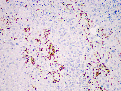 Immunohistochemistry of paraffinembedded Human liver tissue with MPO Monoclonal Antibody(Antigen repaired by EDTA).