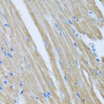 Immunohistochemistry of paraffin-embedded Mouse heart using CCM2 Polyclonal Antibody at dilution of 1:100 (40x lens).