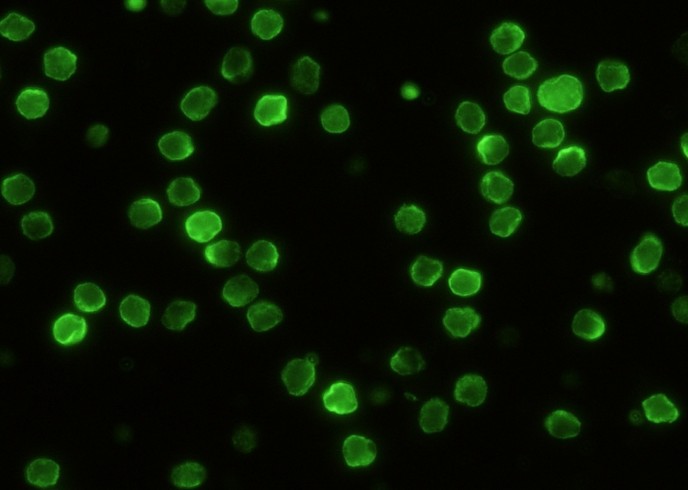 Recombinant LY9/CD229/SLAMF3 Monoclonal Antibody - small - 2