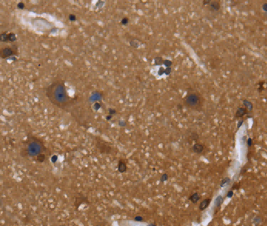 FGFR1OP Polyclonal Antibody - 2