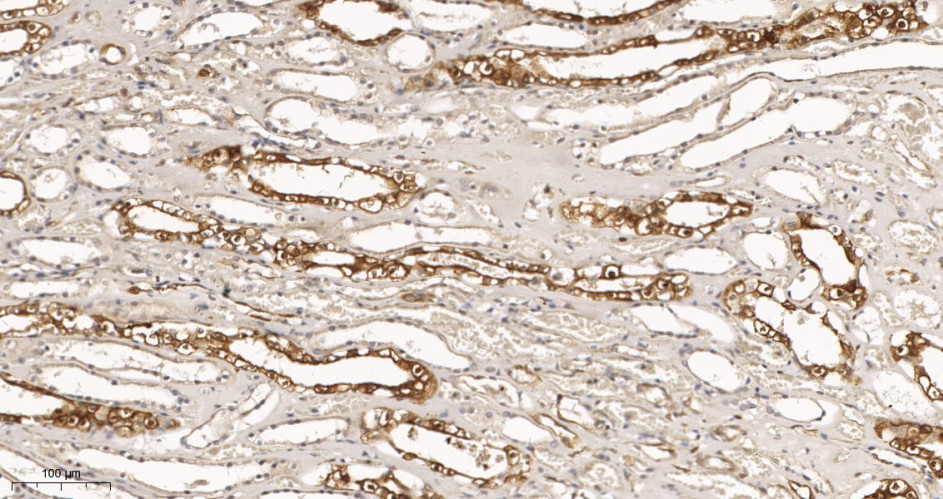Recombinant STAT1 α Monoclonal Antibody - small - 2