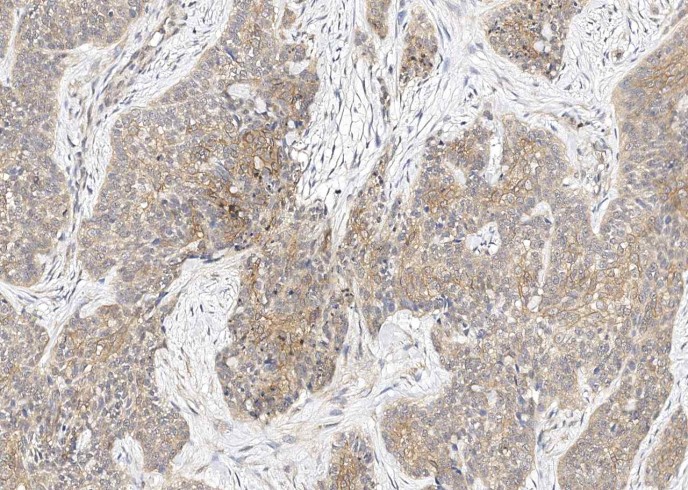 TROP2/TACSTD2 Monoclonal Antibody - small - 9