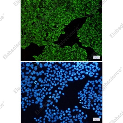 Recombinant ENO3/beta-enolase Monoclonal Antibody - 2