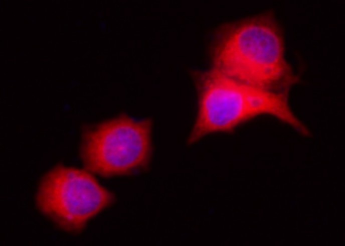 Recombinant LRPAP1/A2MRAP Monoclonal Antibody - small - 1