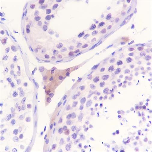 Recombinant WWOX Monoclonal Antibody - 2