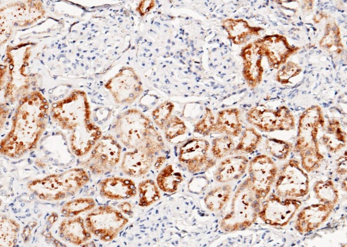 LRPAP1 Monoclonal Antibody-searchlist-1