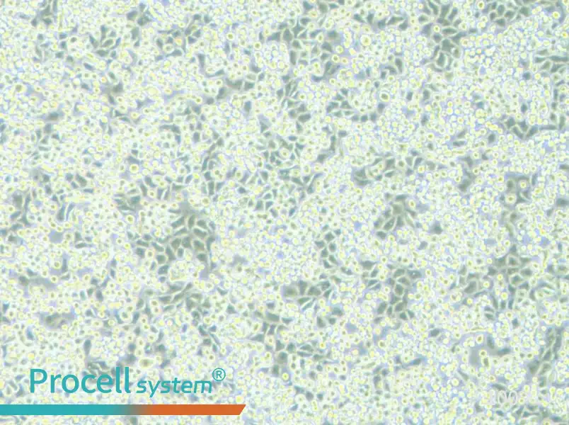 NCI-H2122 Cell Complete Medium - 1