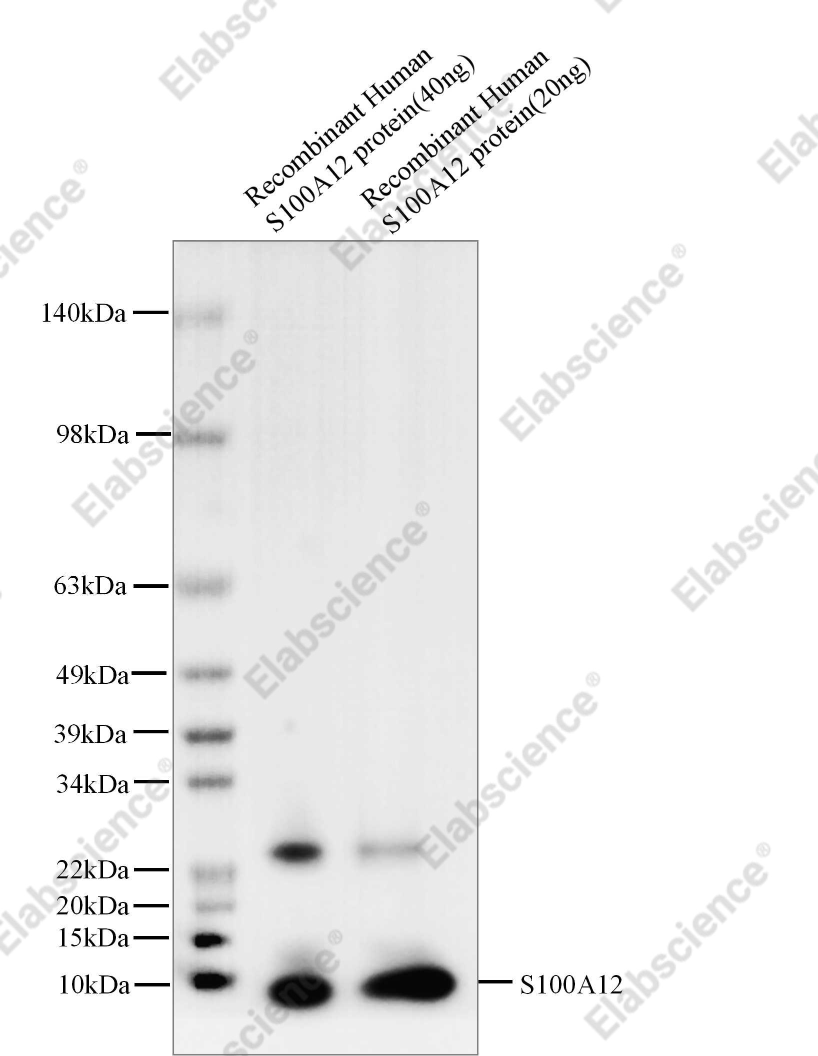 Recombinant S100A12 Monoclonal Antibody - 1