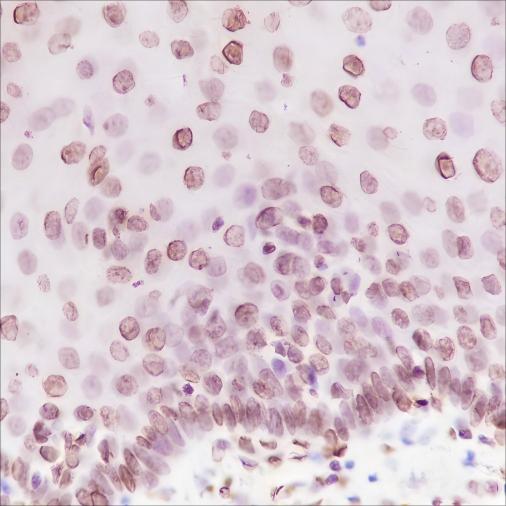 Recombinant Phospho-Cyclin D1 (Thr286) Monoclonal Antibody - small - 3