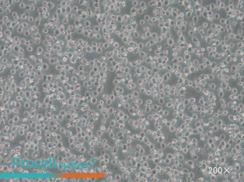 OCI-AML-3 Cell Complete Medium - small - 4