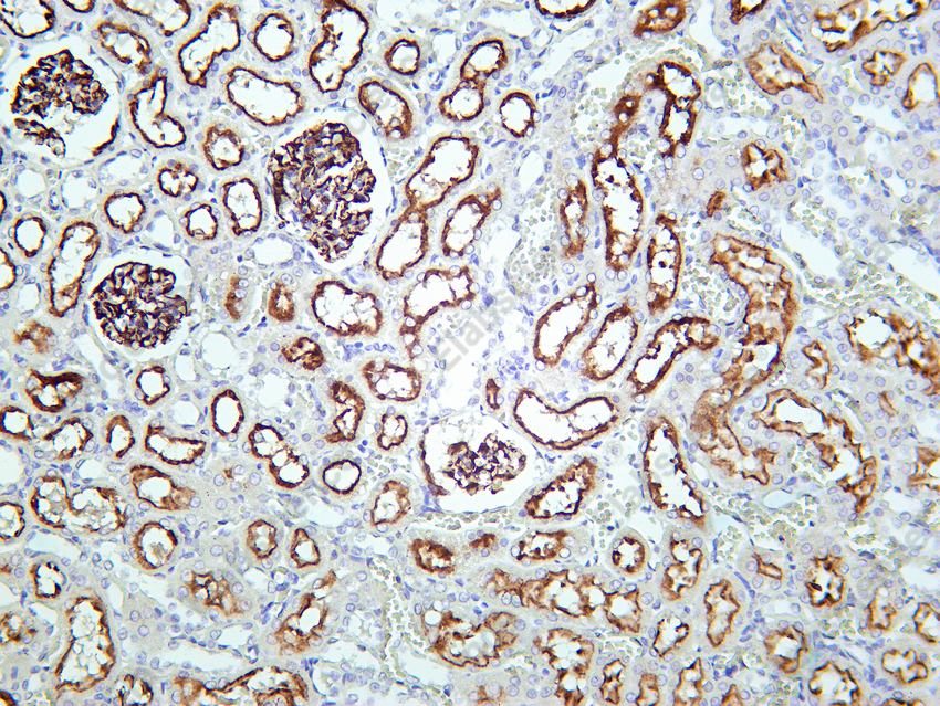 Recombinant NLRP3 Monoclonal Antibody - 4