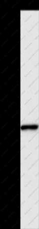 INHBA Polyclonal Antibody - 1