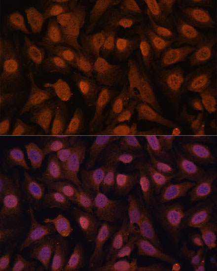 Immunofluorescence analysis of U-2 OS cells using ZNF131 Polyclonal Antibody at dilution of  1:100. Blue: DAPI for nuclear staining.