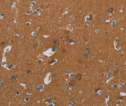 Immunohistochemistry of paraffin-embedded Human brain tissue using OMG Polyclonal Antibody at dilution 1:30