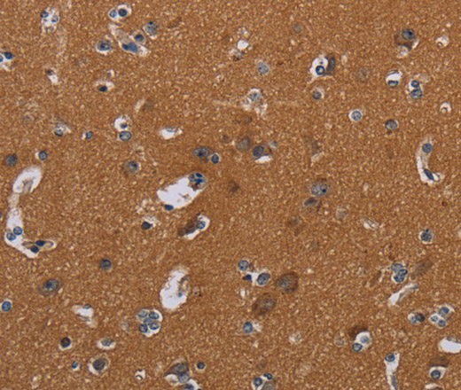 Immunohistochemistry of paraffin-embedded Human brain  tissue using OMG Polyclonal Antibody at dilution 1:30