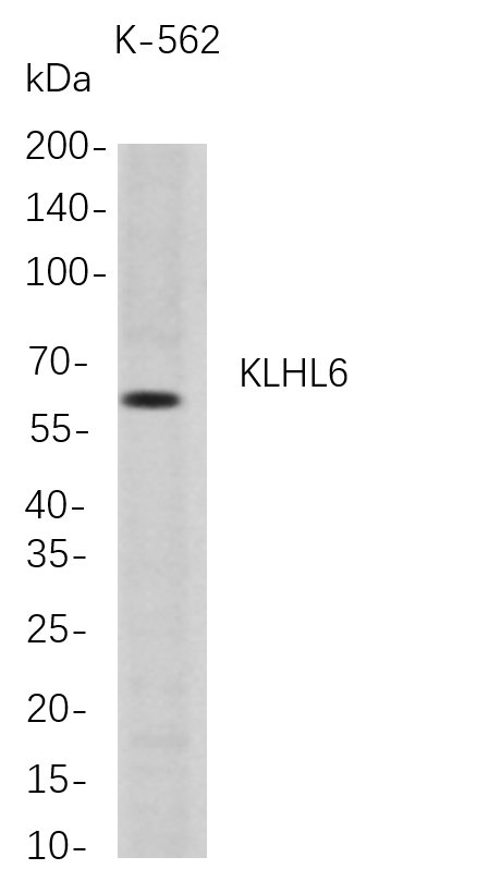 Recombinant KLHL6 Monoclonal Antibody-searchlist-1