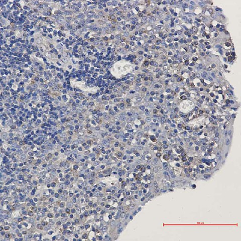 Immunohistochemistry of alpha Tubulin in paraffin-embedded Human tonsil using alpha Tubulin Rabbit mAb at dilution 1:50