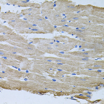 Immunohistochemistry of paraffin-embedded Rat heart using TARS Polyclonal Antibody at dilution of 1:100 (40x lens).
