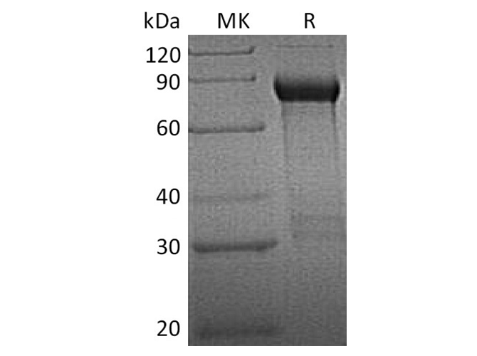 Recombinant Human GFRA1/GDNFRA Protein (Fc Tag)
