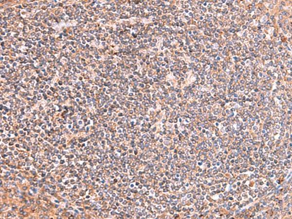 Immunohistochemistry of paraffin-embedded Human tonsil tissue  using PHKG2 Polyclonal Antibody at dilution of 1:60(?200)