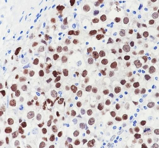 Recombinant SOX17 Monoclonal Antibody - 2