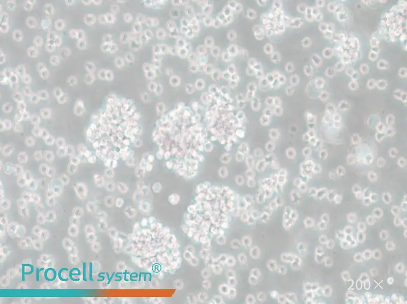 SU-DHL-6 Cell Complete Medium - 5