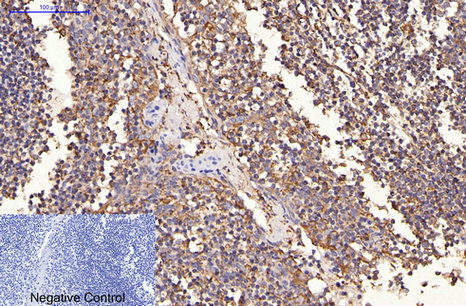 Immunohistochemistry of paraffin-embedded Human tonsil tissue using ERBB2 Monoclonal Antibody at dilution of 1:200.