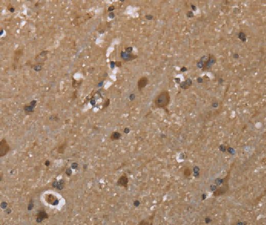 GALK1 Polyclonal Antibody - 3