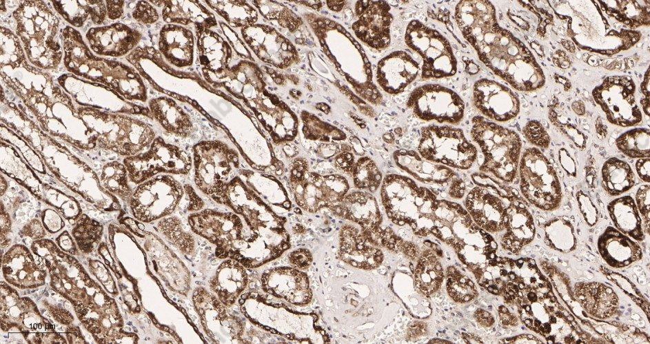 Recombinant Bad Monoclonal Antibody - 2