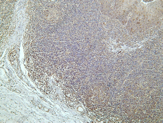 Recombinant Wnt5b Monoclonal Antibody - 1