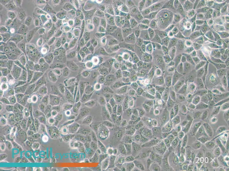 VK2/E6E7 Cell Complete Medium - small - 6