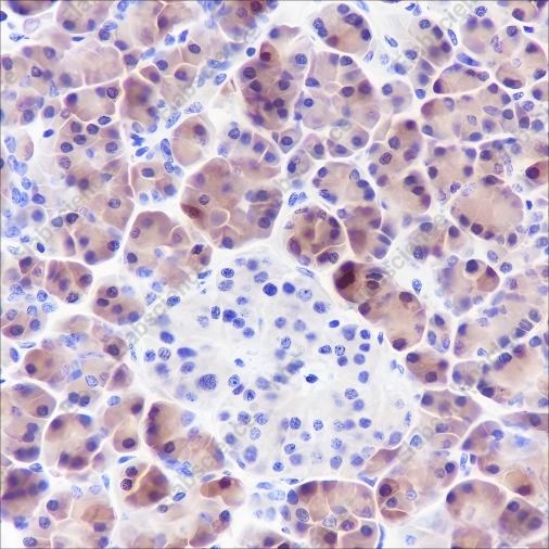 Recombinant SPINK1 Monoclonal Antibody - 1