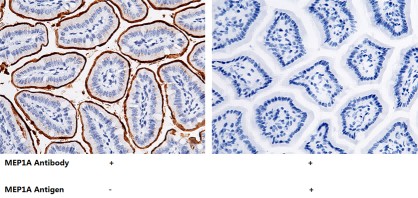 Recombinant MEP1A Monoclonal Antibody - small - 2