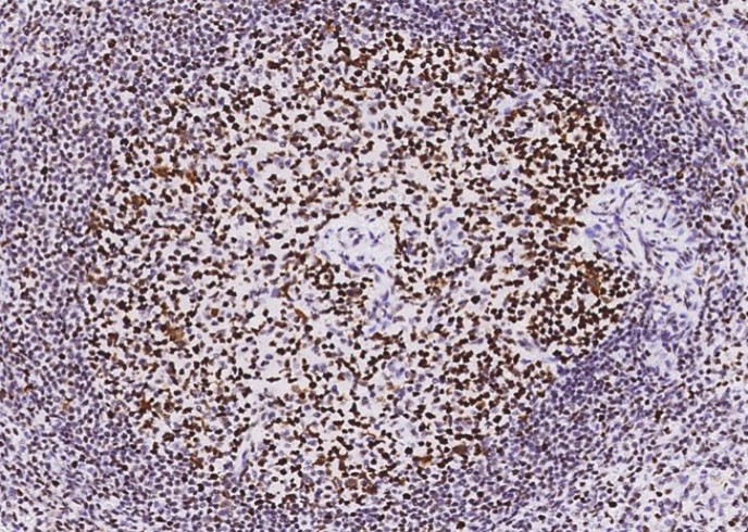 Recombinant MSH6/GTBP Monoclonal Antibody - small - 4