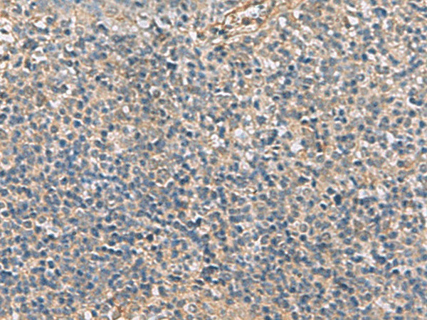 Immunohistochemistry of paraffin-embedded Human tonsil tissue  using APOBR Polyclonal Antibody at dilution of 1:35(?200)