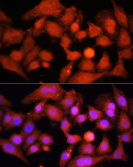 Immunofluorescence analysis of HeLa cells using PGC1 alpha Polyclonal Antibody at dilution of  1:100. Blue: DAPI for nuclear staining.